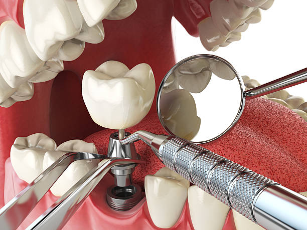 Reynoldsburg, OH Emergency Dentist Pros